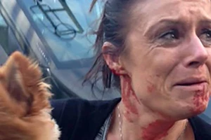 Một phụ nữ phải đổ máu để bảo vệ tính mạng chú chó cưng