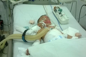 Vụ hai trẻ bị rơi xuống hồ rồi cho vào lu hơ trên lửa: Một bé đã tử vong