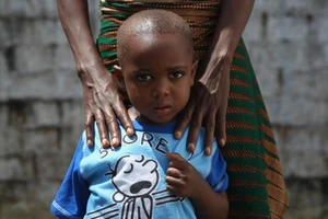 Giải mã khả năng bệnh nhân Ebola thoát án tử