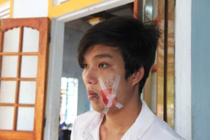 Dân: 'Bị Công an xã bắn', Công an xã: 'Lạc đạn'