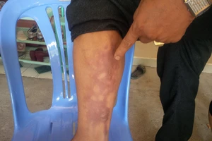 Nhóm côn đồ lao vào nhà dân chém tán loạn rồi ném bom xăng