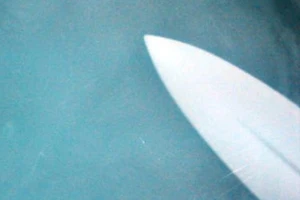 Trung úy CSGT bị đâm thủng bụng tại quán karaoke