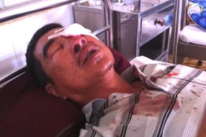 Bị cáo ném đá làm vỡ nhãn cầu hành khách bị phạt 4 năm tù