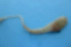 Trứng rắn có thể nằm trong lòng đỏ trứng gà hay không?