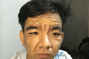 Chàng trai 23 tuổi hóa ông già 60