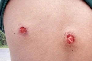 Một công dân phản ánh bị thiếu tá công an bắn vào lưng