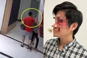 Vụ người cha bị chủ chó hành hung khi bảo vệ con: Đề nghị xử lý nghiêm!