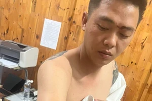 8 người liên quan vụ chém phó công an xã ở Lâm Đồng bị bắt