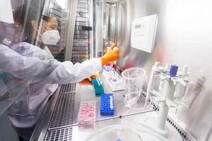 Đậu mùa khỉ lây nhanh nhưng khó thành đại dịch