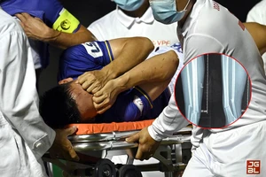 Hùng Dũng ôm mặt đau đớn khi được đưa ra xe cứu thương.