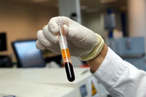 Nhân viên phòng thí nghiệm Israel giữ mẫu máu phục vụ cho việc xét nghiệm huyết học tại phòng thí nghiệm Trung tâm chăm sóc y tế Leumit ở TP Or Yehuda, gần thủ đô Tel Aviz (Israel).