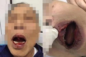 Công an vào cuộc vụ công chức đánh tiến sĩ 76 tuổi 