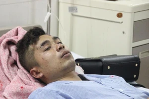 Nạn nhân trên xe khách nổ kể lại giây phút kinh hoàng 