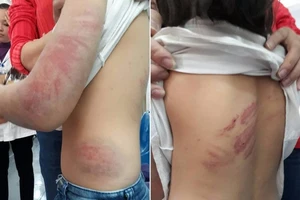 Bắt giam người cha đánh đập con gái 9 tuổi