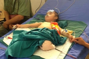 Đá đè sập nhà, bé trai 4 tuổi bị mất hai chi