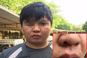 Phóng viên bị hành hung khi vừa rời khỏi UBND phường