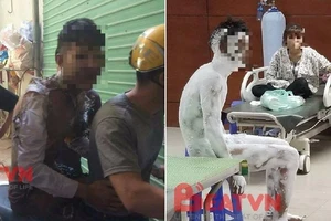 Nam thanh niên tự thiêu, nghi do cãi với bạn gái