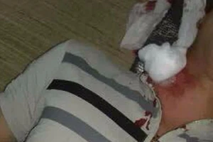 Nghi đạn lạc trúng cổ khi đang nằm trong nhà