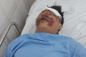 Truy tìm tài xế tông nguy kịch 2 sinh viên rồi bỏ chạy