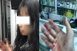 Tài xế Uber bị tố đánh khách chảy máu