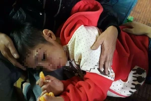 Vụ bé trai 10 tuổi bị bạo hành: Mẹ kế khai gì?