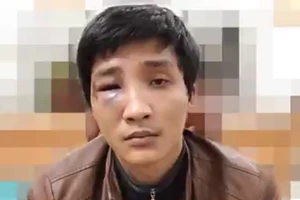 1 thanh niên vô cớ chửi, đánh người khác