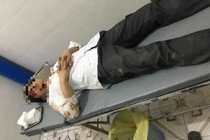 Đi đòi nợ bị đánh nhập viện