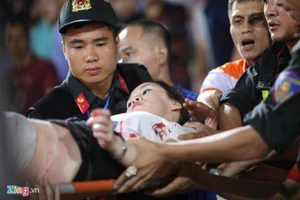 Công an vào cuộc vụ bắn pháo sáng khiến nữ CĐV bỏng nặng