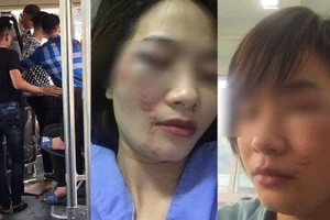 Nữ phụ xe buýt bị bốn thanh niên hành hung