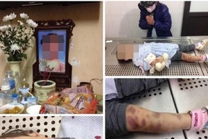 Bé gái 3 tuổi tử vong nghi bị cha mẹ bạo hành