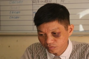 1 CSGT bị người vi phạm tông xe, tấn công