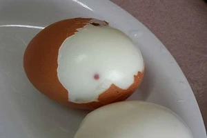 Không có chuyện trứng gà tiêm máu nhiễm HIV