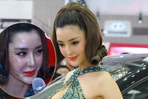 Hàng vạn người tàn phế vì giải phẫu thẩm mỹ