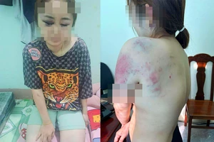 Công an điều tra vụ người phụ nữ bị 'chồng hờ' bạo hành suốt 13 giờ