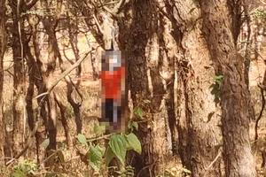 1 người đàn ông chết trong tư thế treo cổ ở đồi thông