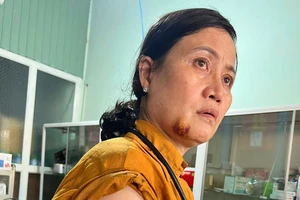 Nữ nhân viên y tế kể giây phút hoảng loạn do bị nhóm đàn ông vây đánh