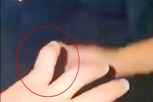 Công an xác minh vụ khách tố bị chủ quán cơm gà đánh gãy ngón tay 