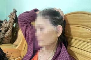 Phẫu thuật thẩm mỹ trái phép khiến 1 phụ nữ nhập viện cấp cứu 