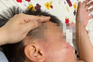Công an xác minh vụ học sinh lớp 4 bị giáo viên dạy thêm tiếng Anh tát vào mặt