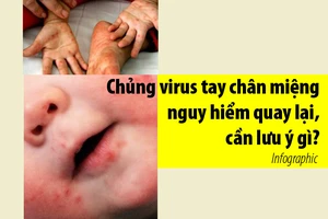 Chủng virus tay chân miệng nguy hiểm quay lại, cần lưu ý gì?