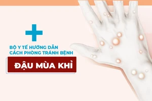 Bộ Y tế hướng dẫn cách phòng tránh bệnh đậu mùa khỉ