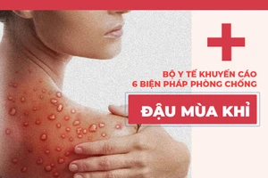 Bộ Y tế khuyến cáo 6 biện pháp phòng chống đậu mùa khỉ
