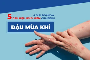 4 giai đoạn và 5 dấu hiệu nguy hiểm của bệnh đậu mùa khỉ