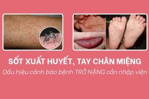 Dấu hiệu cảnh báo bệnh sốt xuất huyết và tay chân miệng trở nặng cần nhập viện 