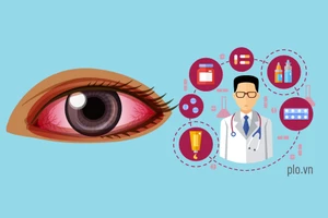 5 thắc mắc thường gặp khi bị đau mắt đỏ