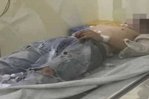 Đôi nam nữ tự tử ở khu Đại học TP.HCM