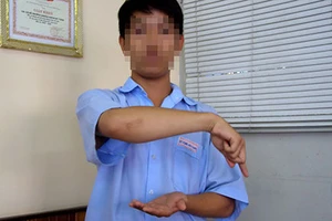 Loạn ký hiệu ngôn ngữ cho người câm điếc