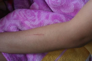 Nạn rạch người đi đường lan tới Nha Trang