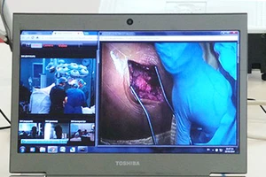 Mổ bệnh nhân từ xa