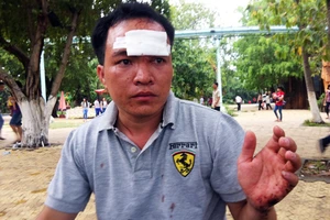 Đi chơi lễ, bị cướp hành hung ngay tại Đầm Sen